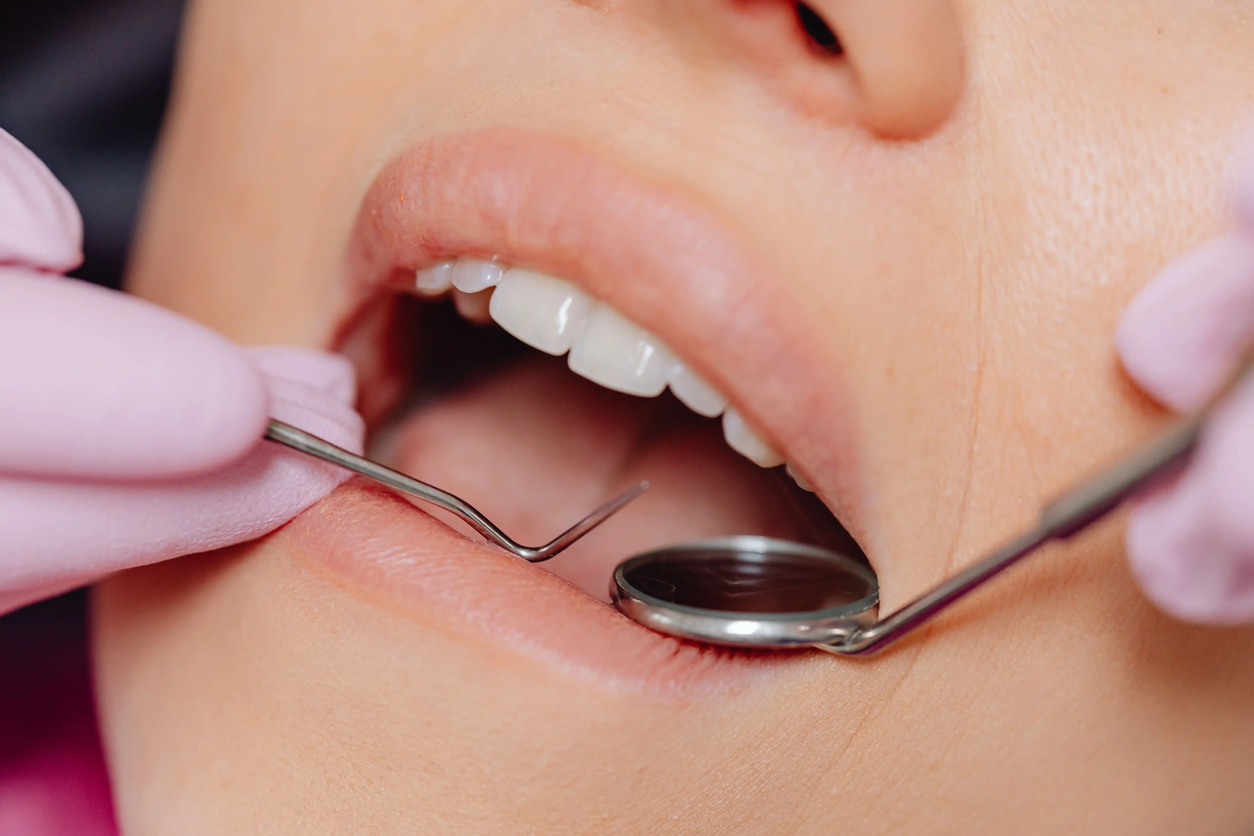 Dental Checkups & Examinations