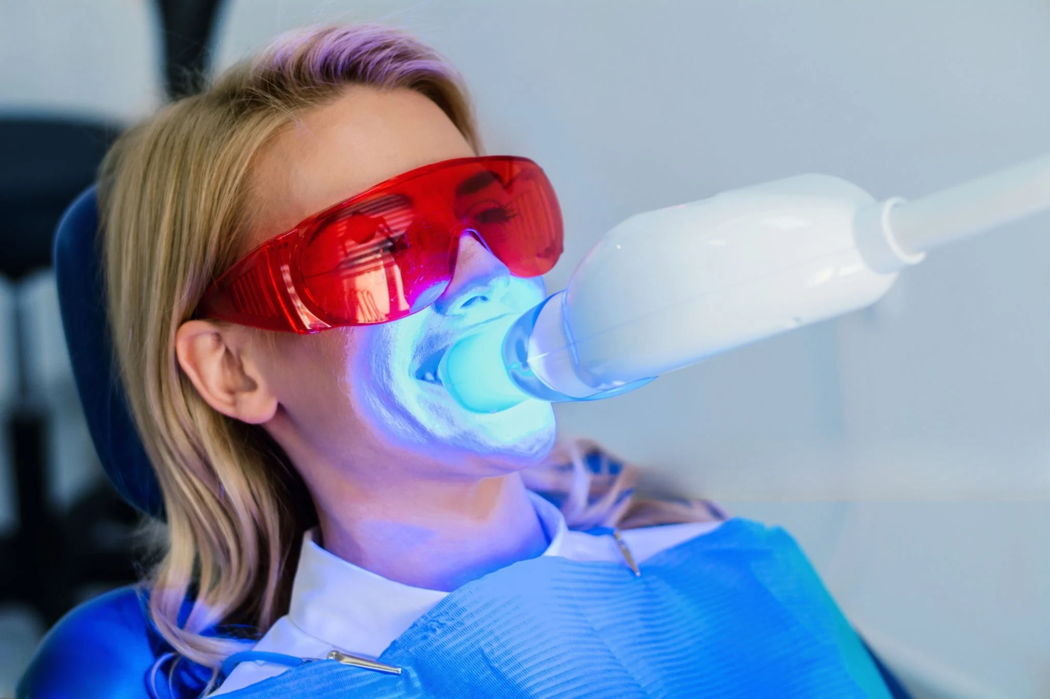Teeth Whitening